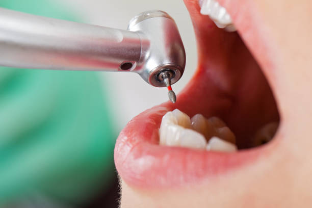 Best Emergency Tooth Extraction  in Mountain View, AR